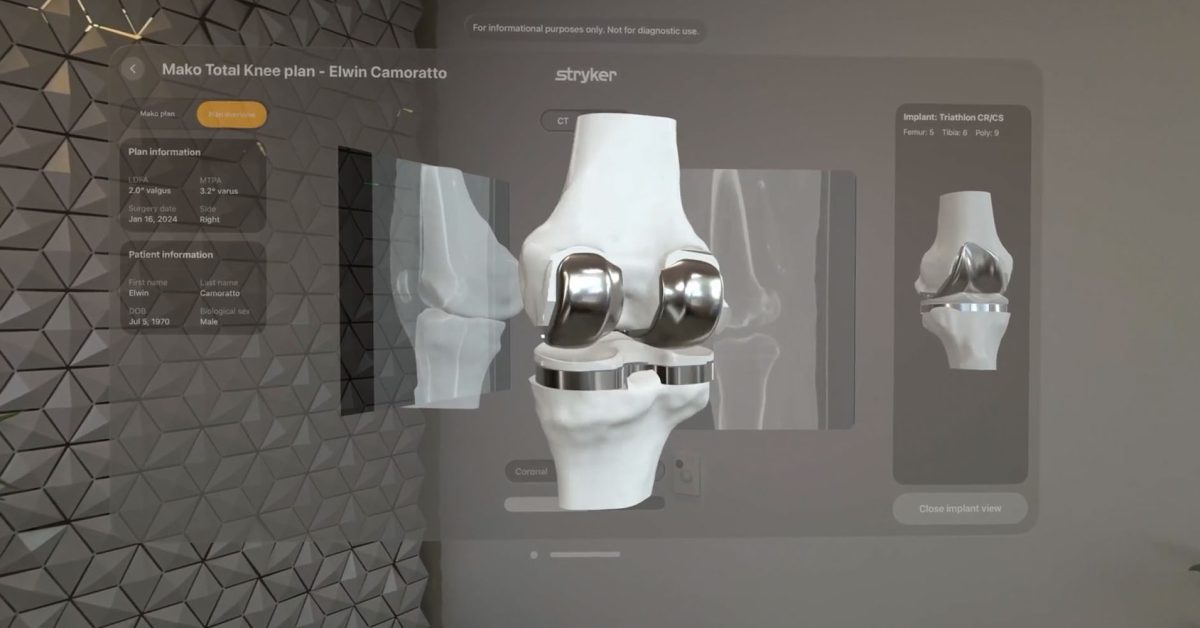 Vision Pro helps surgeons plan and visualize operations with robot