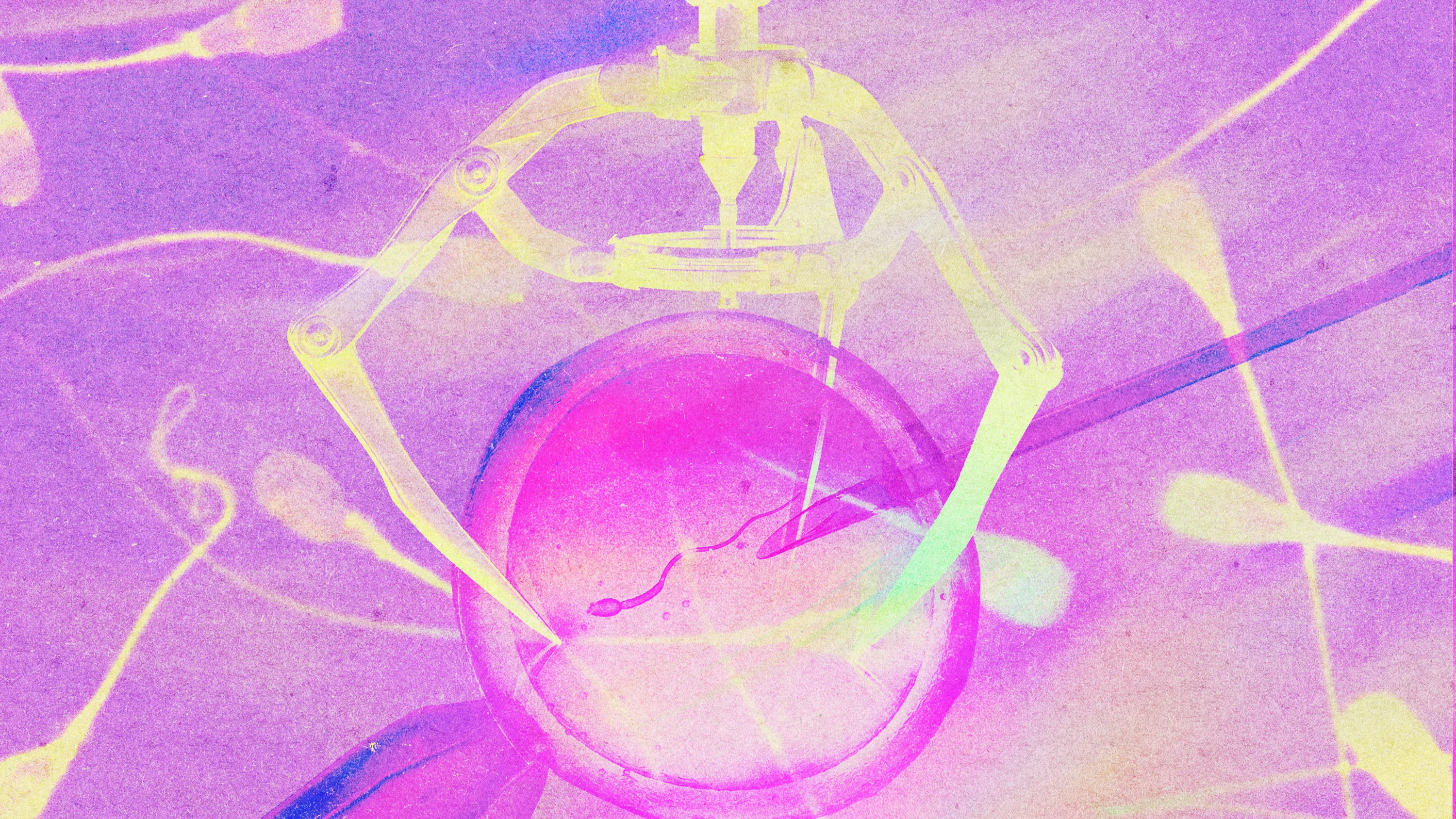 What’s Next for IVF: AI, Data & Global Accessibility