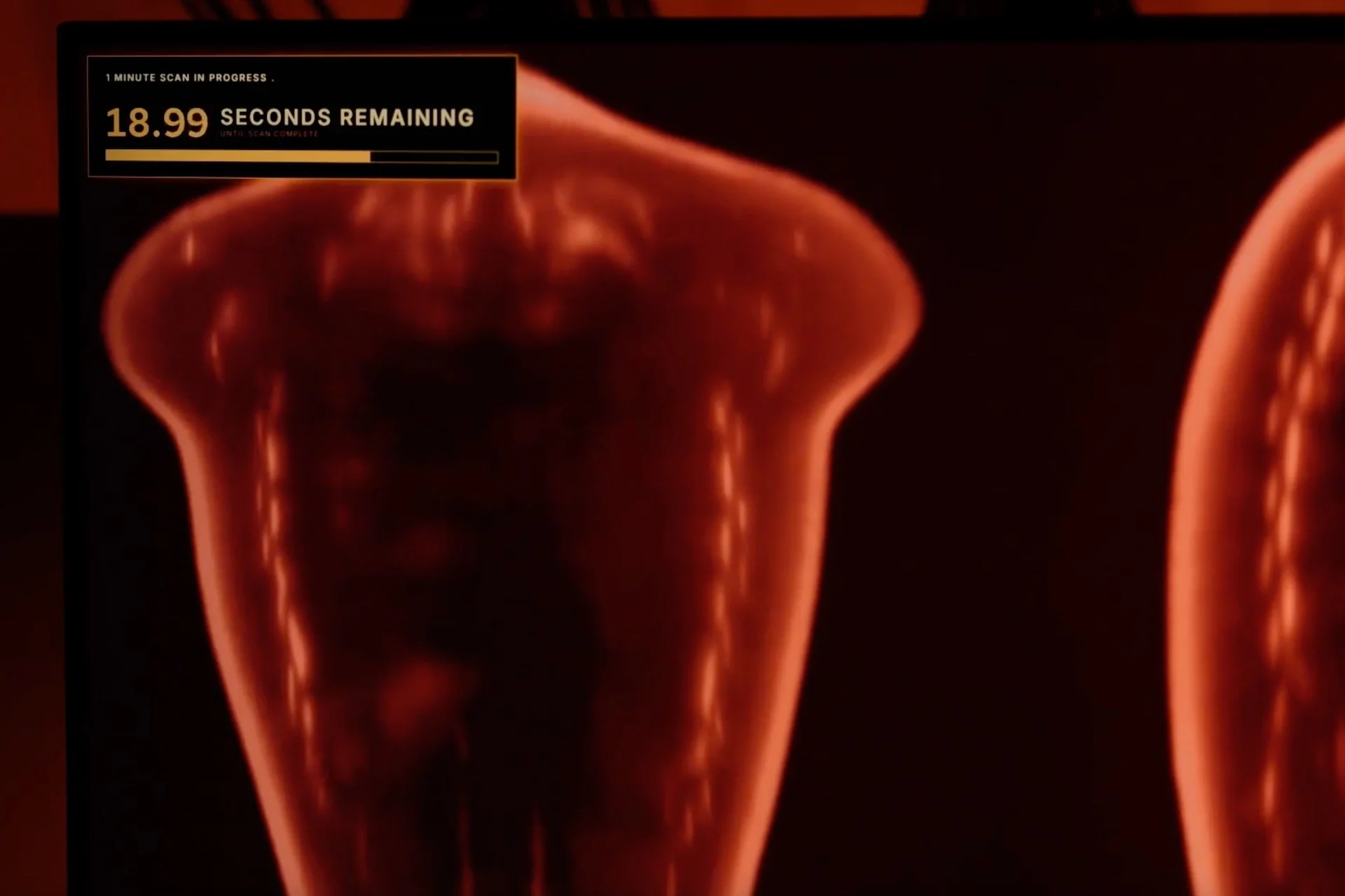 Remember Midjourney? It’s Building a Medical Scanning Device That It Says Is Faster Than an MRI