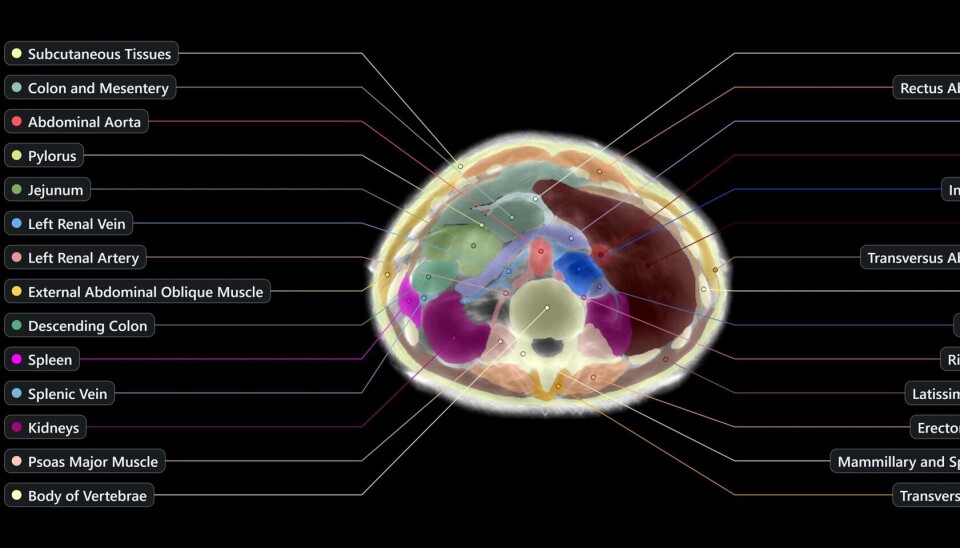 A processed image of the midsection of a human body scanned by the Midjourney Scanner
